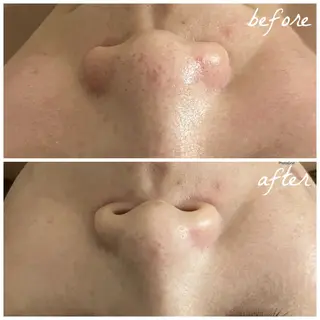 メンズ メナード岐阜茜部 杉浦のエステ・リラクイメージ