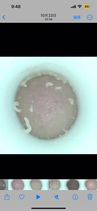 《美肌･小顔》美容鍼 ＆マッサージ＊MEIのエステ・リラクイメージ