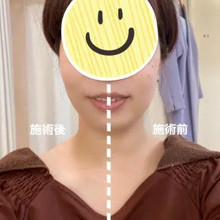 小顔美肌&ヘアメイク 丸山紗來のその他イメージ