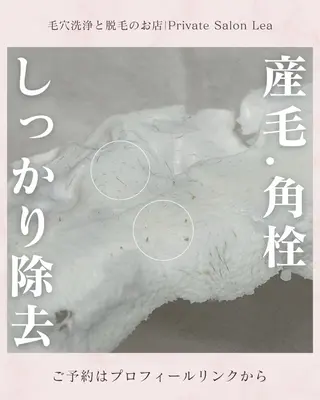 Lea堺東　毛穴洗浄 ×顔ワックス脱毛のその他イメージ