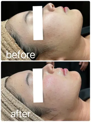 💫Linola💫 レイビス　小林のエステ・リラクイメージ