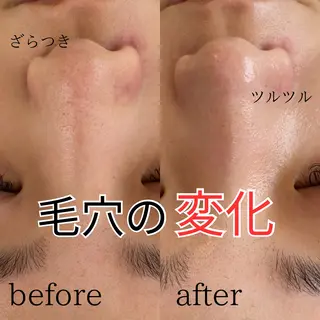 mavie（メヴィ）所属・毛穴洗浄肌管理サロン mavieのエステ・リラクイメージ