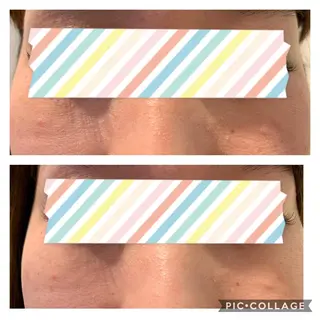 肌改善エステ/ POLA水口のエステ・リラクイメージ