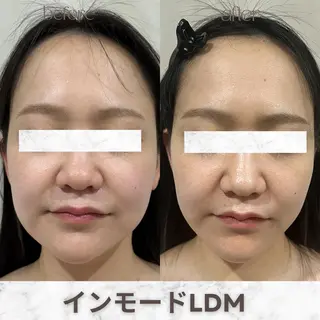 aimer 服部のその他イメージ