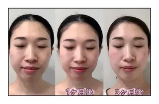 ヘアアレンジ ネイル マツエク・マツパ QANAEL 小山のエステ・リラクイメージ