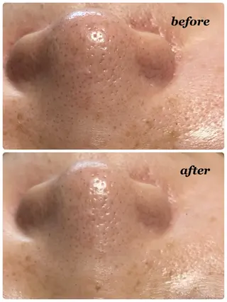 安達 洋子のエステ・リラクイメージ