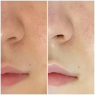 LUARAフェイシャルサロン 新御徒町店所属・ルアラ エステのエステ・リラクイメージ