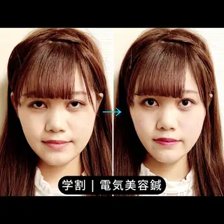 渋谷 小顔美容鍼 専門サロン YZのエステ・リラクイメージ