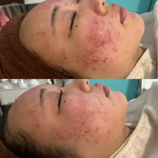 韓国肌管理 Belleのエステ・リラクイメージ