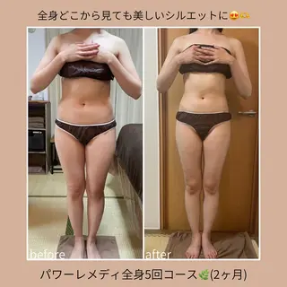 《本気痩せ×疲労改善 》  BILOOPのエステ・リラクイメージ