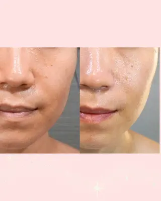 【エイジングケア肌質改善フェイシャル専門】Thanq-サンク-所属・サンク 飯田（イイダ）のエステ・リラクイメージ