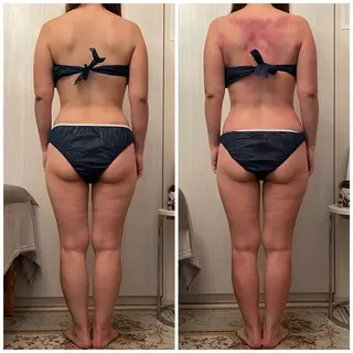 食べながら魅せボディ éclatJua川越のエステ・リラクイメージ