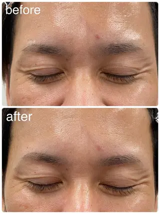 メンズ アイブロウ Mubye所属・Yamagtchi hinaのエステ・リラクイメージ