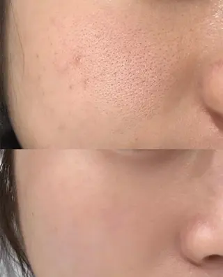 ネイル aliaハーブ水光店 エステティシャン募集のエステ・リラクイメージ