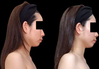 Ichi Fluo rite Bodyのエステ・リラクイメージ