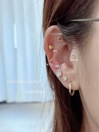 smileskin 京都/meguのその他イメージ