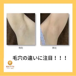 エピット横浜磯子店 大森のエステ・リラクイメージ