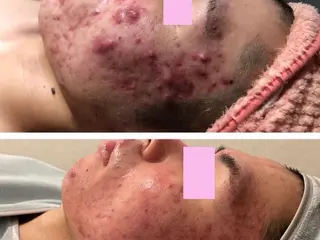 🌼SALON Lazuli久留米のエステ・リラクイメージ