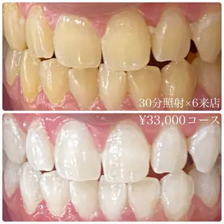 メンズ ホワイトニング ルーム　川崎店のその他イメージ