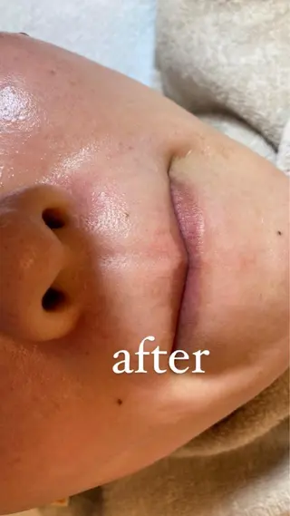 Le cherien ルシェリアのエステ・リラクイメージ