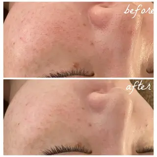 メンズ メナード岐阜市茜部 杉浦のエステ・リラクイメージ