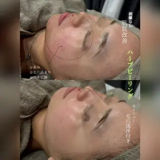 心斎橋🤍堀江.小顔 ハーブ.痩身クレビアのエステ・リラクイメージ