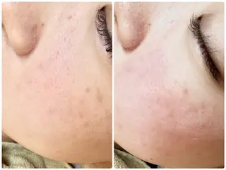 フェイシャル&アイブロウサロンRRR所属・アイブロウワックス フェイシャルサロンの眉毛・アイブロウイメージ