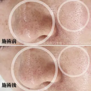 毛穴ケア専門サロン アメリオボーテのその他イメージ