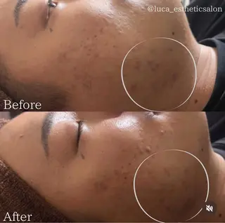 Luca 痩身• 疲労改善×韓国肌管理のエステ・リラクイメージ