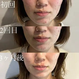 森島 美樹のエステ・リラクイメージ