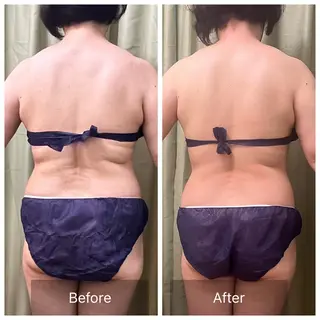 【元に戻らない】 小顔&部分痩せのその他イメージ