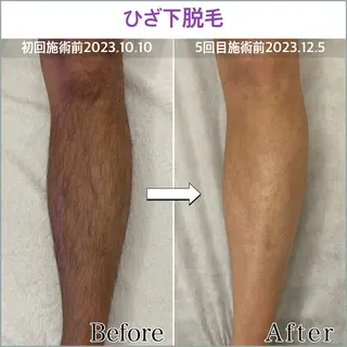 プライベートサロン エル〜aile～のエステ・リラクイメージ