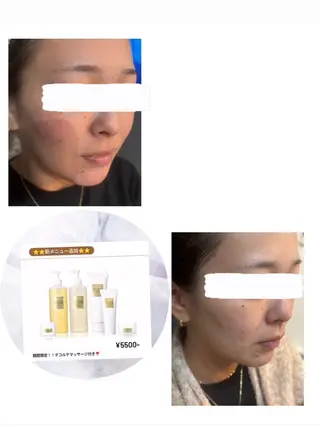 代謝アップ，浮腫み， 体質改善のエステ・リラクイメージ