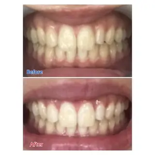 Ｍ渋谷 ホワイトニングのエステ・リラクイメージ