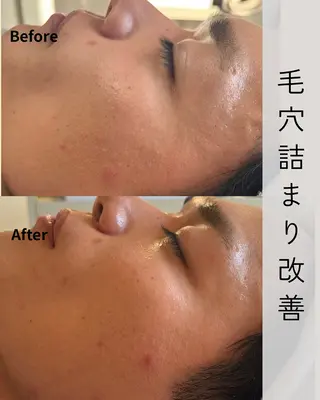 Novelle所属・nozomi.m🌷 narisのエステ・リラクイメージ