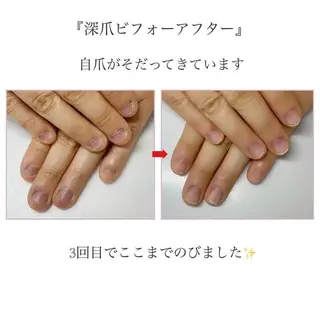 ネイル ネイルサロン アリュームのネイルデザイン