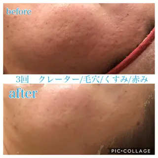 ロング カラー パーマ ヘアアレンジ メンズ キッズ ネイル マツエク・マツパ EnsorClair 代表 野口真央のエステ・リラクイメージ