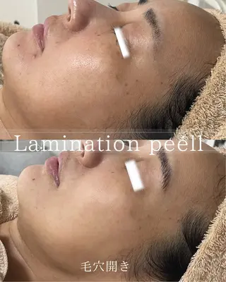 北浜/毛穴洗浄ツヤ肌 サロンaniRのエステ・リラクイメージ