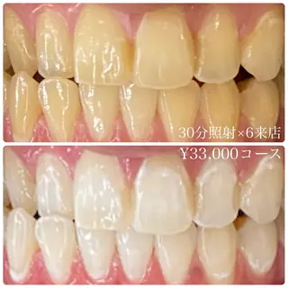 メンズ ホワイトニングルーム　川崎店所属・ホワイトニング ルーム　川崎店のその他イメージ