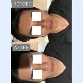 🎀肌質改善🫧 小山のエステ・リラクイメージ