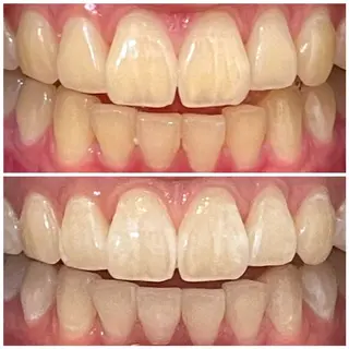 DIAMOND BEAUYのその他イメージ