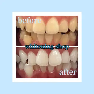 ホワイトニングショップ光明池店所属・ホワイトニング ショップ光明池店のエステ・リラクイメージ