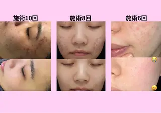 マツエク・マツパ 愛維美水光美肌専門店 メンズレディースokのエステ・リラクイメージ