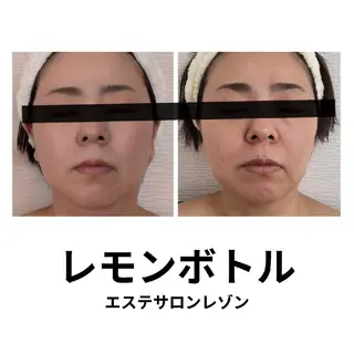 〈ニキビケアサロン〉 レゾン京橋店/ 浅川のエステ・リラクイメージ