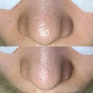 Re:Belle 久留米 : 中島のエステ・リラクイメージ