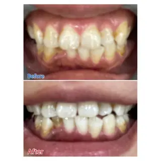 M渋谷 ホワイトニングのエステ・リラクイメージ