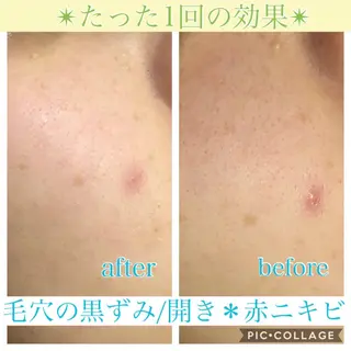 ロング カラー パーマ ヘアアレンジ メンズ キッズ ネイル マツエク・マツパ EnsorClair 代表 野口真央のエステ・リラクイメージ