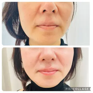 POLA 北花田店のエステ・リラクイメージ