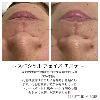 ビューティー ミロワールのエステ・リラクイメージ