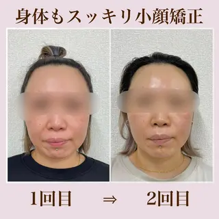 小顔矯正サロン Lilyのエステ・リラクイメージ